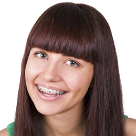 acceledent aura testimonials