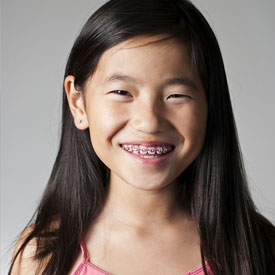 early orthodontic treatment